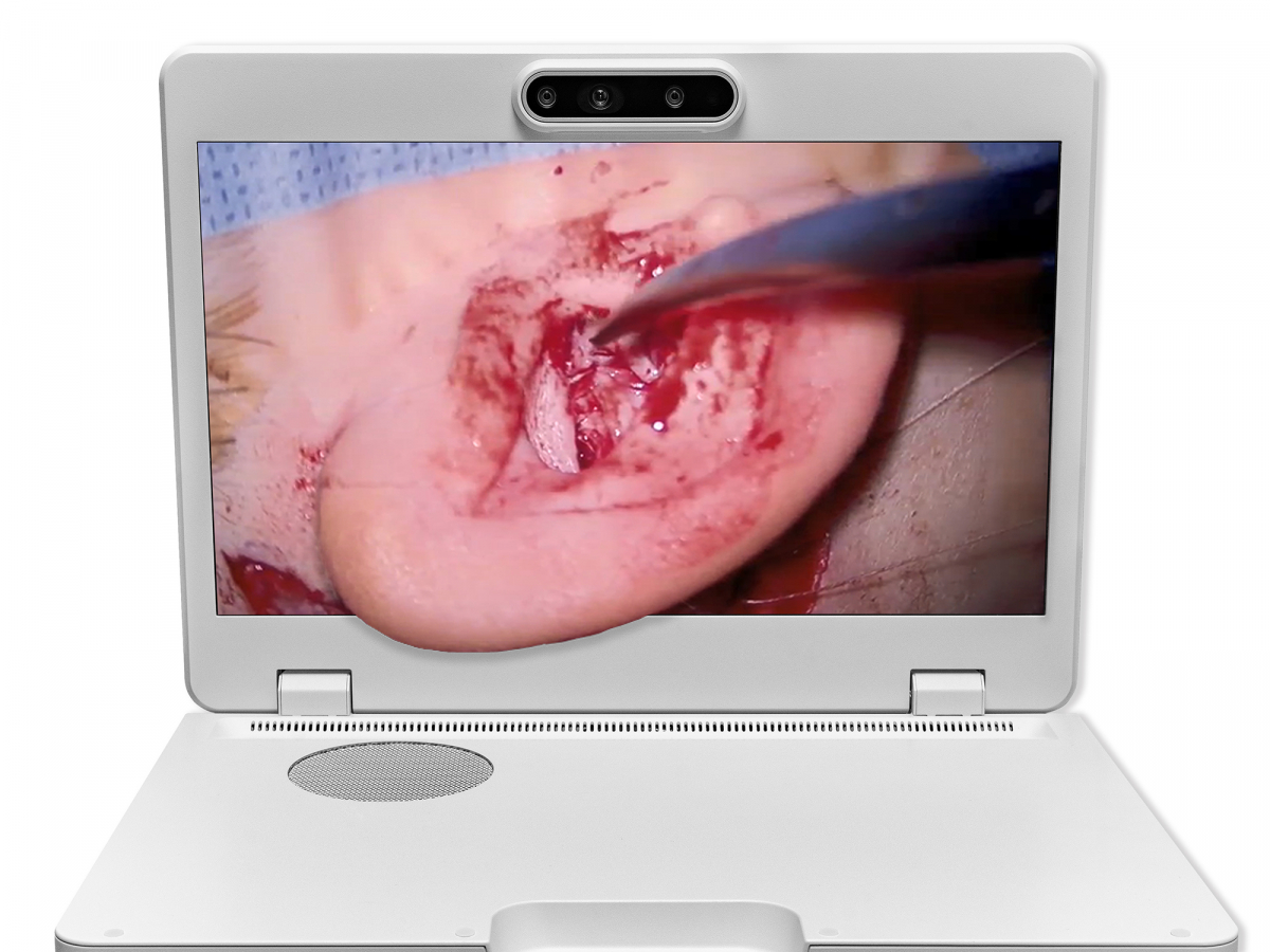 达擎之＂Heads-up 3D显微手术显示系统＂，整合4K裸眼3D显示及眼球追踪系统，具备快速追踪人眼移动位置功能，减轻医师长时间维持固定姿势的负担，让医师能有更宽广清晰的3D立体视野及更舒适的姿势来执行手术。